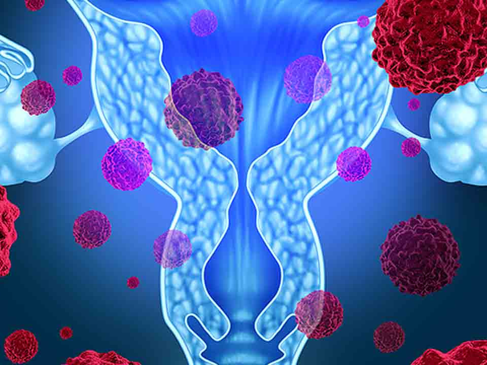 尖銳濕疣會自愈嗎