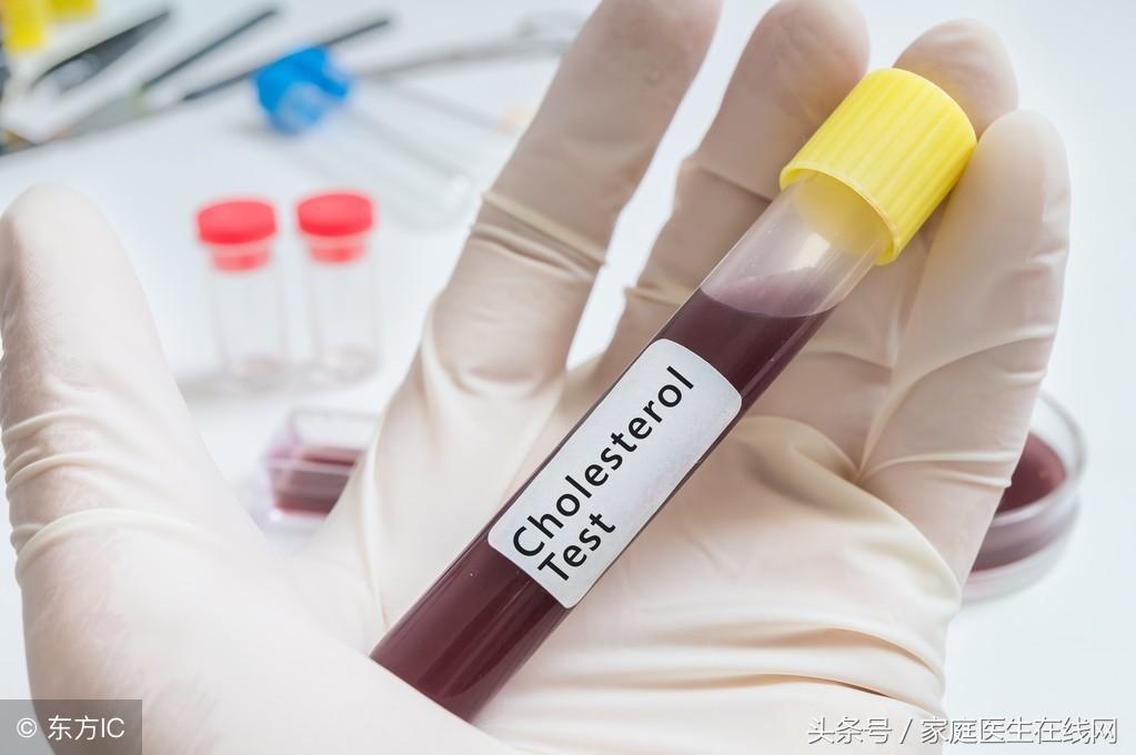 糖尿病的成因，深度解析其背后的原因，深度解析糖尿病成因，揭示背后原因真相