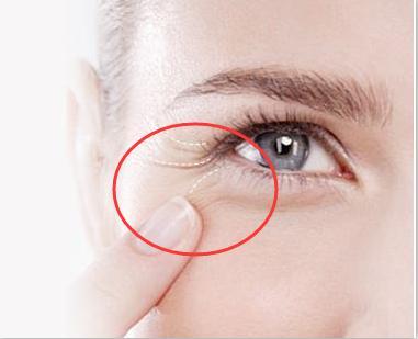 如何去除魚尾紋，最佳方法與實用建議，去除魚尾紋，最佳方法與實用建議攻略