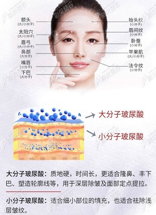 玻尿酸的作用與功效，深入了解玻尿酸的奧秘，玻尿酸的作用與功效揭秘，深入了解玻尿酸的神奇之處